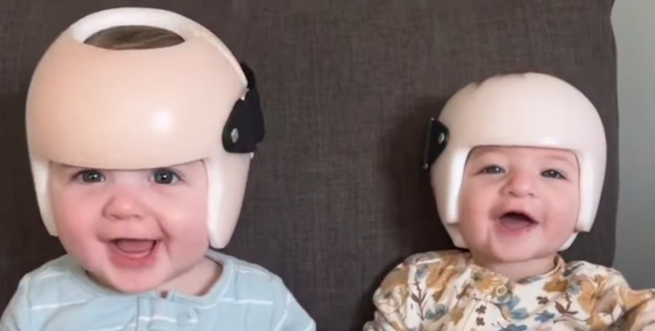 Двое улыбающихся близнецов в ортопедических шлемах, которые носят их для коррекции формы головы