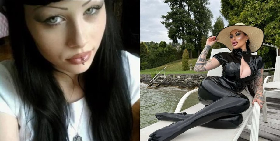 Коллаж с фотографиями женщины до и после кардинальных изменений внешности с помощью косметических процедур