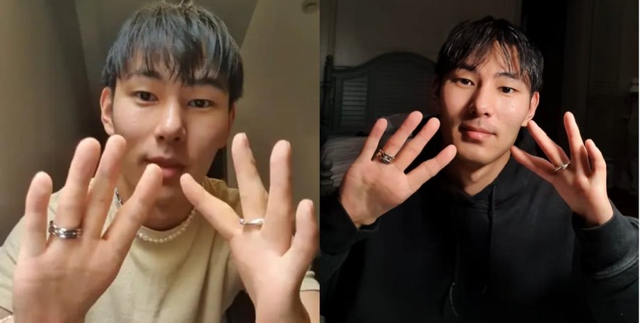 Цяо Алберс демонстрирует свои руки без больших пальцев в разных видео